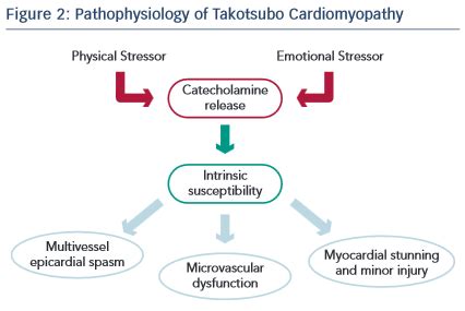 Journal of the american college of cardiology vol. Takotsubo (Stress) Cardiomyopathy?