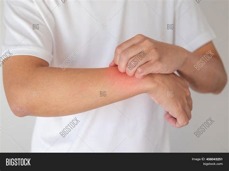 Man Itching Scratching Image And Photo Free Trial Bigstock