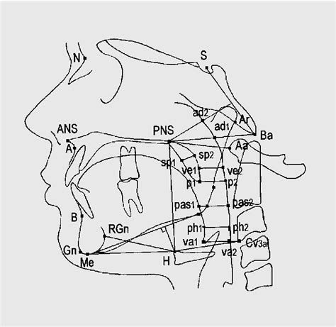 Figure 1 From Comparisons Of Speech Aerodynamics And Lateral