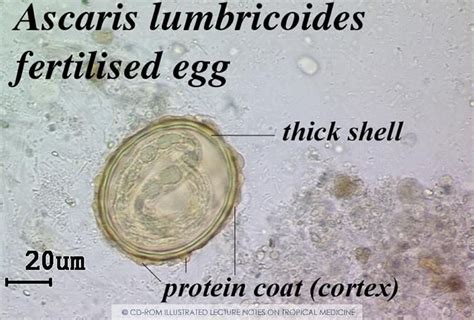 55 Hd Can Parasite Eggs Be Seen In Stool Insectpedia