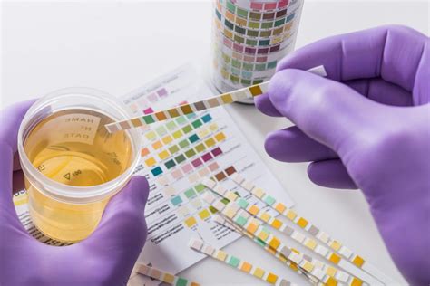Quais doenças o exame de urina detecta Descubra aqui Blog PAT Análises Clínicas