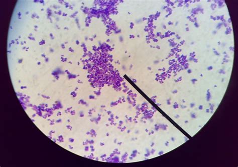 Bentuk Bakteri Staphylococcus Aureus Homecare