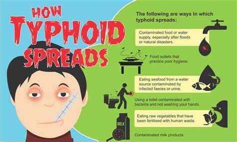 Typhoid Fever Spread HealthGist Net