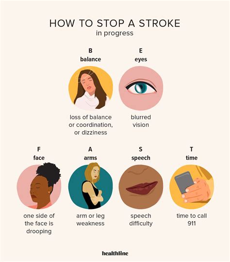 How To Identify And Stop A Stroke In Progress