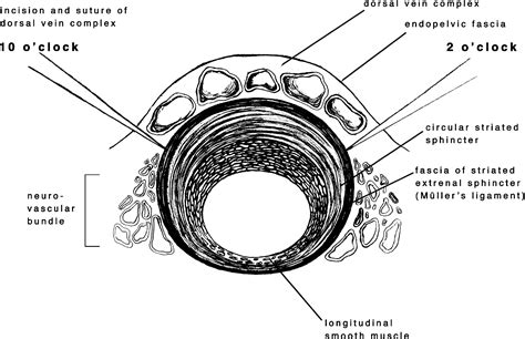 Open Retropubic Nerve Sparing Radical Prostatectomy European Urology