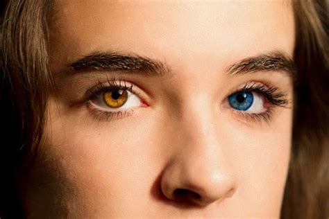 Heterochromia A Beautiful Mutation — Steemit Color De Ojos Fotos