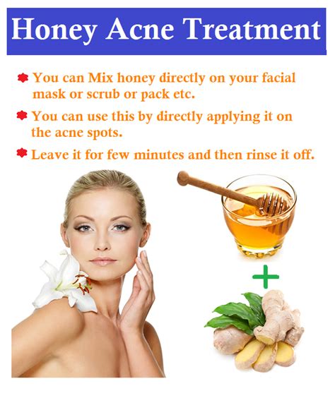 Pin By Smita On Beauty Honey For Acne Health And Beauty Beauty Remedies