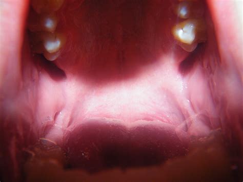 Inside A Human Mouth Porn Hub Sex