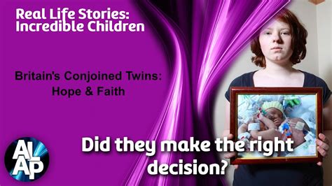 Conjoined Twins Hope And Faith Documentary Youtube