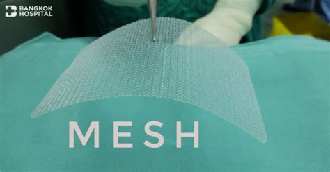 Technology Mesh Repair Strengthening The Abdominal Wall Reduction Of