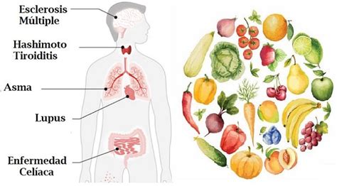 Deficiencias De Nutrientes Relacionadas Con Enfermedades Autoinmune