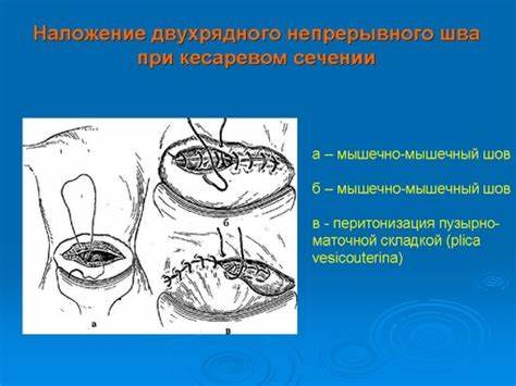Кесарево диета в первые дни