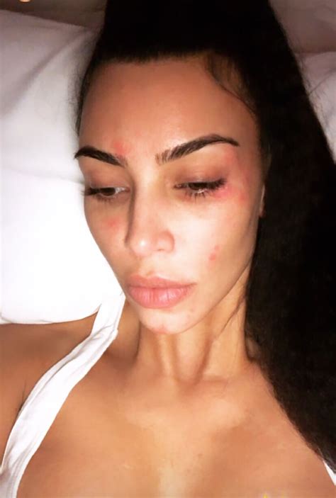 Discover the latest collections from kkw beauty by kim kardashian west. Kim Kardashian Documents Psoriasis in 'Morning' Selfie ...