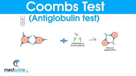 Coombs Test Antiglobulin Test Made Simple Youtube
