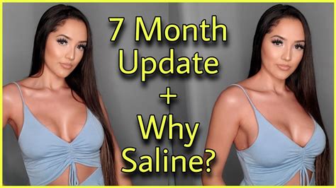 7 Month Update Of 450cc Saline Breast Implants Why I Chose Saline