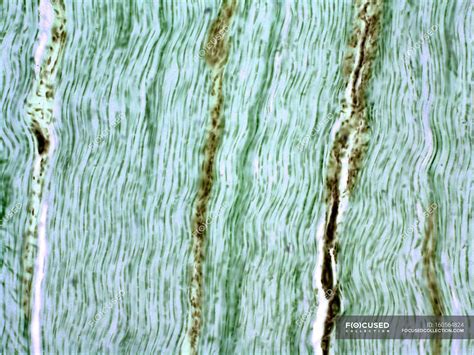 Tendon Showing The Parallel Collagen Fibres — Light Microscope Light