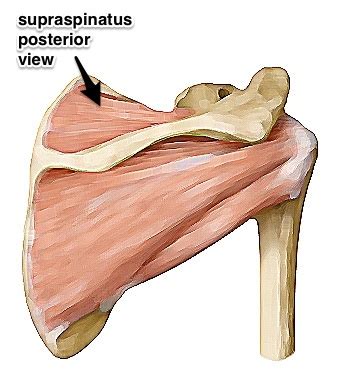 A supraspinatus tendon tear is a common throwing injury. Shoulder / ПЛЕЧИ: Supraspinatus - Rotator Cuff Muscle