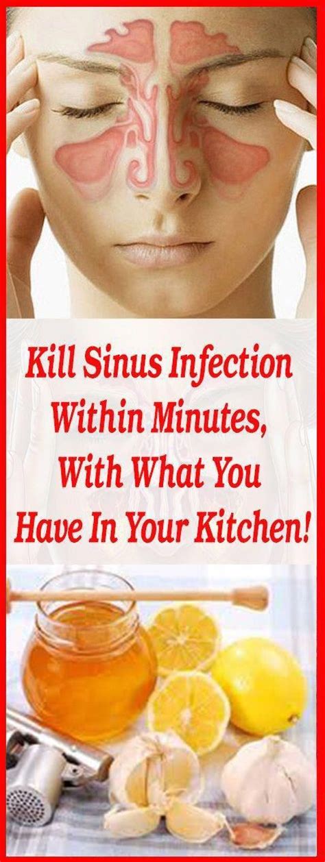 one of the best home remedy for sinus infection medical health diet home remedies for sinus