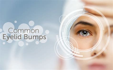 Eyelid Bumps Common Conditions And Symptoms