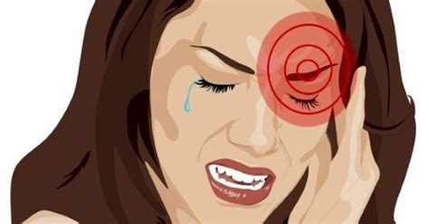 Headache Behind Left Eye Migraine Headaches Headache Behind Eyes