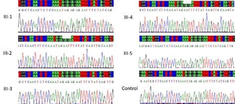Sanger Sequence Analysis For Validation Of Exome Sequencing Probands Download Scientific