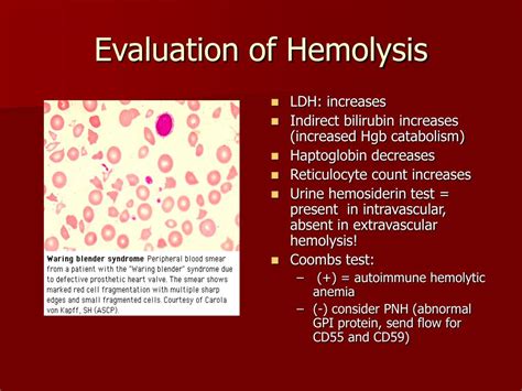 Ppt Anemia Powerpoint Presentation Free Download Id1310026