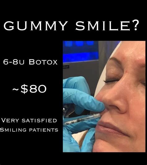 People of all ages can get treatment to fix gs. Gummy Smile? Easy Fix! - Botox, Med Spa - Artistic Touch ...