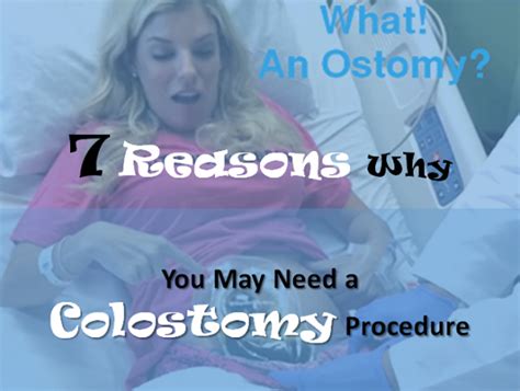 7 Reasons Why You May Need To Have Colostomy Surgery Youmemindbody