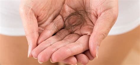 Alopecia Hair Loss Treatment Hair Essential Care