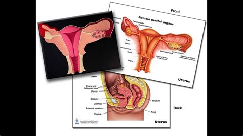 Gynecological Problems Module Amenorrhea Testicular Feminization Syndrome And Ovarian Cyst