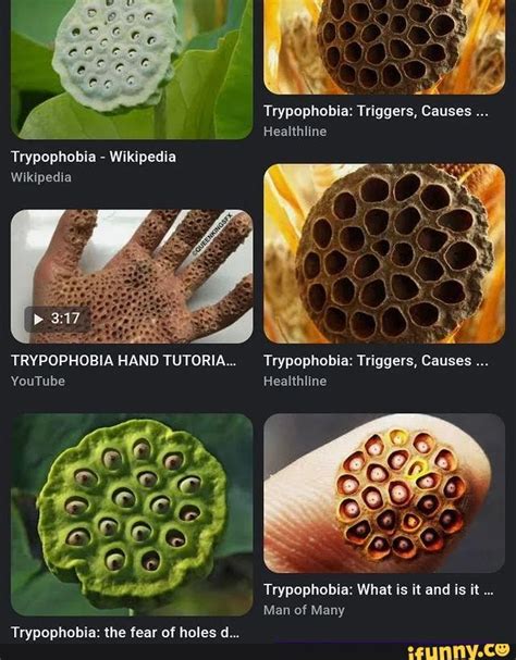 What Is Trypophobia Its Definition Causes Pictures And Cure Explained Images And Photos Finder