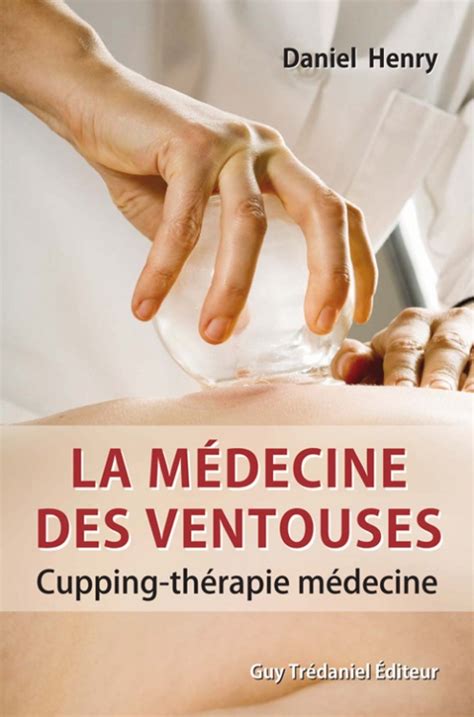 La Médecine Des Ventouses Cupping Therapie Médecine T2 Daniel Henry