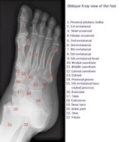 Presentation outline • relevant anatomy • x ray positioning • interpretation of x rays • lines and angles • relevant pathology. X-ray of the foot oblique view | MyFootShop.com