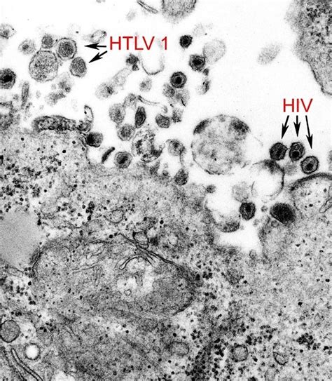 5 Humán Immundeficiencia Vírus Hiv Ingyenes Képek