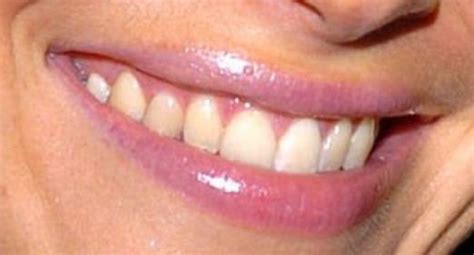 Evangeline Lilly Teeth Pictures