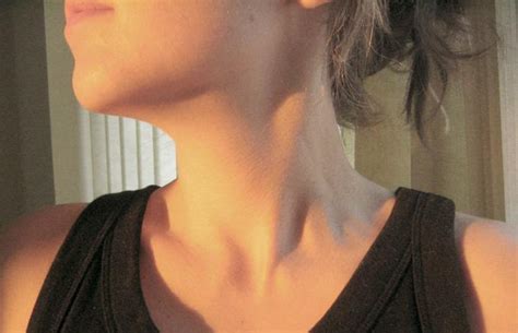 Signs Of Thyroid Disease In Women Thyroid Clinic Sydney