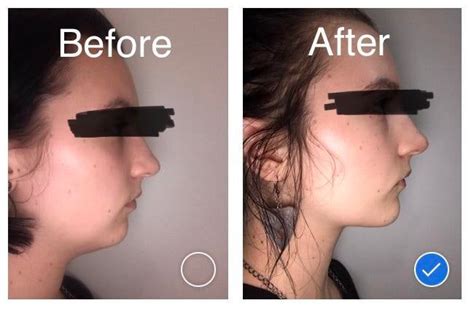 Everything You Need To Know About Mewing Jawline Exercises Chiseled