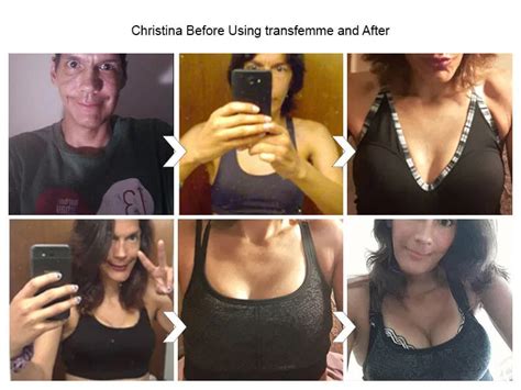 Male Breast Enlargement Photo Male To Female Before And After Hormones Male Breast Breast