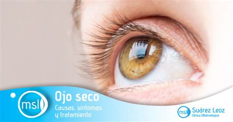 el ojo seco síntomas y tratamiento clínica suarez leoz