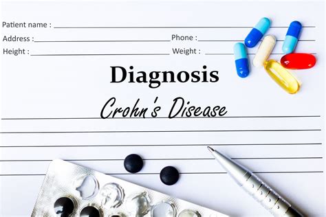 Everything You Need To Know About Crohns Disease Diagnosis
