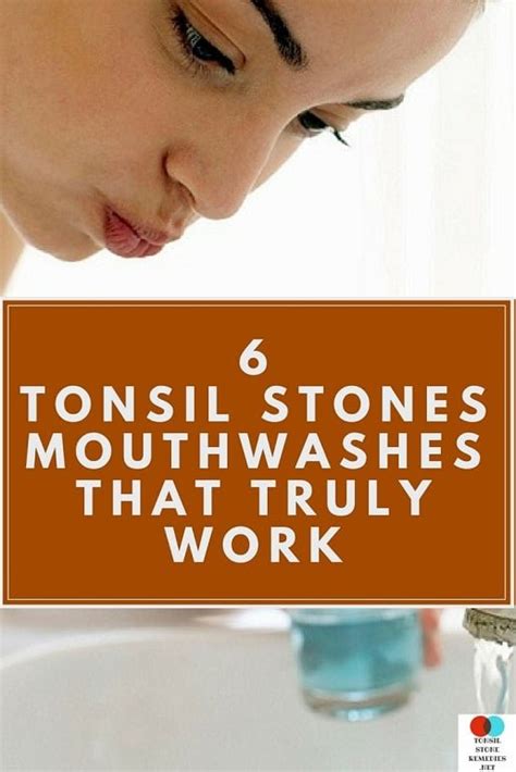 Mouthwash For Tonsil Stones The 6 Best Ones That Truly Work