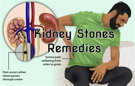 10 Home Remedies For Kidney Stones Home Remedies App