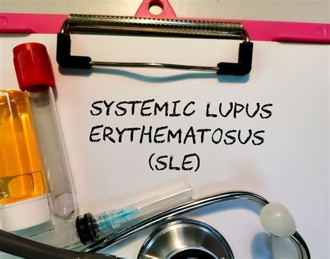 Anifrolumab For Systemic Lupus Erythematosus