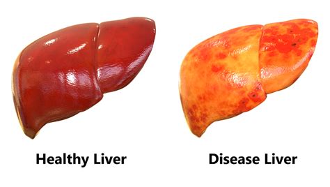 All You Need To Know Essential Facts About Your Liver