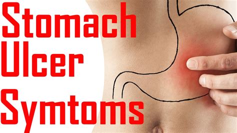Symptoms Of Stomach Ulcers Symptoms Of Peptic Ulcers Peptic Ulcer
