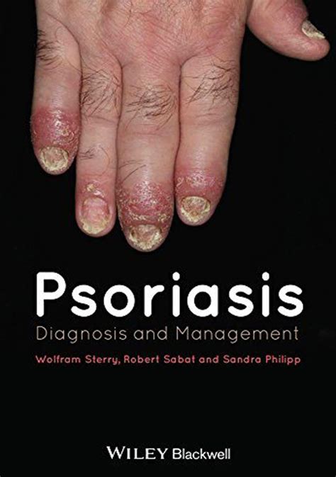 Psoriasis Diagnosis And Management Медкнигасервис