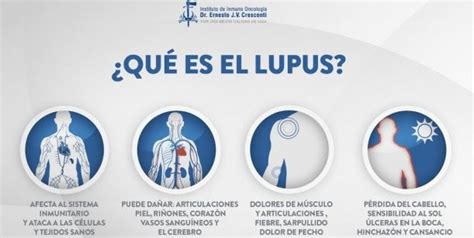Video ¿qué Es El Lupus Cinco Datos Clave De Esta Enfermedad