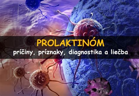 Prolaktinóm A Jeho Liečba