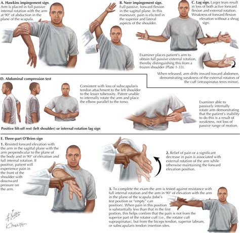 Shoulder Impingement Physical Exam