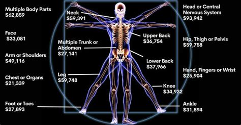 California Workers Comp Settlement Chart By Injury Type And Cause 2023